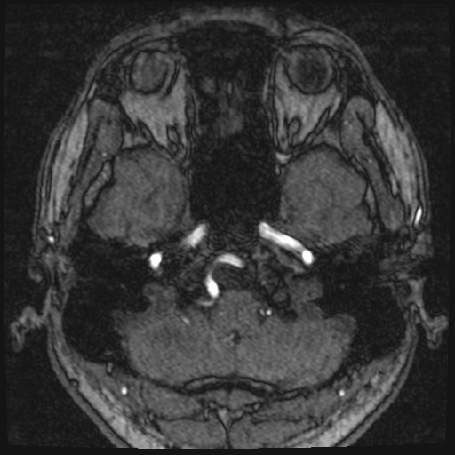 Click on the Serie image to view the images of VILLANUEVA, WILLIAM A.